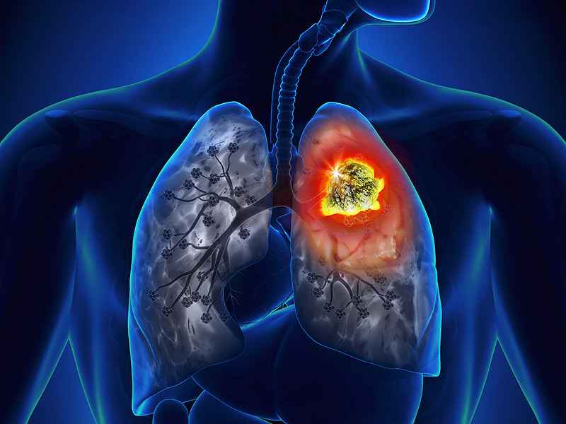 Vaccination With Embryonic Stem Cells Prevents Lung Cancer