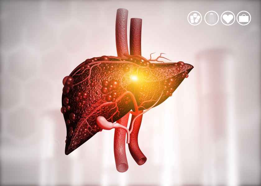 Pluripotent Stem Cells as a Treatment for Liver Failure